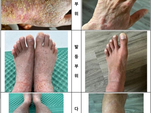 일상 속 외부 자극으로 지친 피부, 5일간의 집중 웰니스 컨디션 케어
